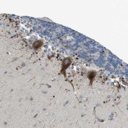 LAMP-1/CD107a Antibody, Novus Biologicals 25 &mu;L | Buy Online | Novus Biologicals | Fisher Scientific