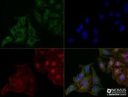 LAMP-2/CD107b Antibody (H4B4) - Azide and BSA Free, Novus Biologicals 0.1