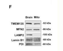 LAMP-2/CD107b Antibody (H4B4) - Azide and BSA Free, Novus Biologicals 0.1