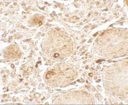 LAMTOR1 Antibody - BSA Free, Novus Biologicals 0.1 mg; Unconjugated:Antibodies,