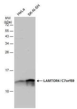 LAMTOR4 Antibody, Novus Biologicals 100 &mu;g | Buy Online | Novus Biologicals | Fisher Scientific