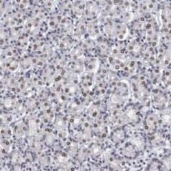 LAP1B Rabbit anti-Human, Polyclonal, Novus Biologicals 25 &mu;g; Unconjugated:Antibodies,