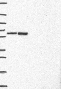 LAP1B Rabbit anti-Human, Polyclonal, Novus Biologicals 25 &mu;g; Unconjugated:Antibodies,