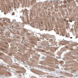 LAPTM4B Antibody (CL5287), Novus Biologicals 100&mu;L:Antibodies, Monoclonal