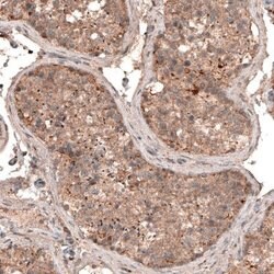 LAPTM4B Antibody (CL5287), Novus Biologicals 100&mu;L:Antibodies, Monoclonal