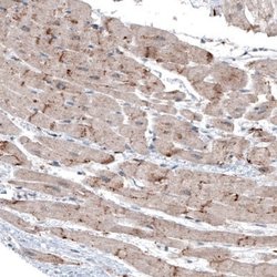 LAPTM4B Antibody (CL5289), Novus Biologicals:Antibodies:Primary Antibodies
