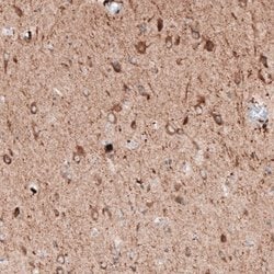LAPTM4B Antibody (CL5289), Novus Biologicals:Antibodies:Primary Antibodies