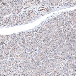 LAPTM4B Antibody (CL5289), Novus Biologicals:Antibodies:Primary Antibodies