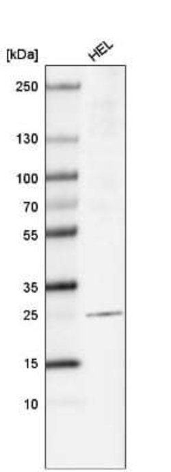 LAPTM4B Antibody (CL5289), Novus Biologicals:Antibodies:Primary Antibodies