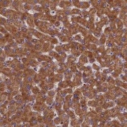 LARP4 Antibody, Novus Biologicals 25 &mu;L; Unconjugated:Antibodies, Polyclonal