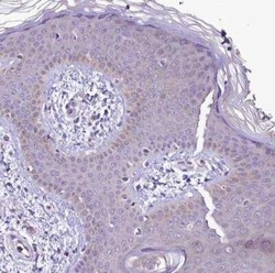 LARP4 Antibody, Novus Biologicals 25 &mu;L; Unconjugated:Antibodies, Polyclonal