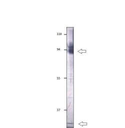 LARP7 Antibody, Novus Biologicals 100 &mu;g | Buy Online | Bio-Techne | Fisher Scientific