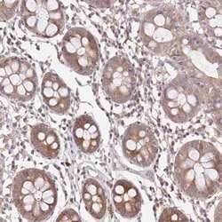 LARS2 Antibody, Novus Biologicals 25 &mu;L, Unconjugated:Antibodies, Polyclonal