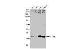 LASS2 Antibody, Novus Biologicals 100 &mu;g | Buy Online | Novus Biologicals | Fisher Scientific