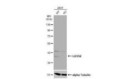 LASS2 Antibody, Novus Biologicals 100 &mu;g | Buy Online | Novus Biologicals | Fisher Scientific