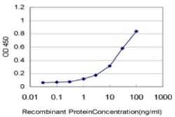 LASS4 Antibody (4B10), Novus Biologicals 0.1 mg; Unconjugated:Antibodies,