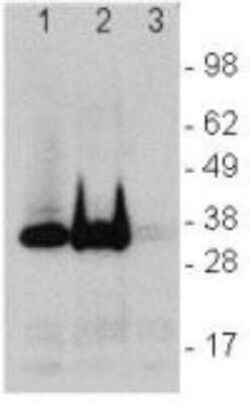 LAT Antibody (LAT.10-17) - BSA Free, Novus Biologicals 100&mu;g; Unlabeled:Antibodies,