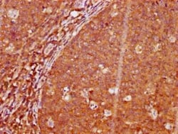 LAT, p Tyr191 Antibody (2E4), Novus Biologicals 100 &mu;g | Buy Online | Novus Biologicals | Fisher Scientific
