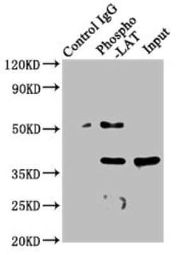 LAT, p Tyr191 Antibody (2E4), Novus Biologicals 100 &mu;g | Buy Online | Novus Biologicals | Fisher Scientific