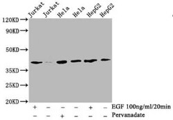 LAT, p Tyr191 Antibody (2E4), Novus Biologicals 100 &mu;g | Buy Online | Novus Biologicals | Fisher Scientific