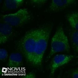 LC3B Antibody (1251B) - Azide and BSA Free, Novus Biologicals 0.1 mg; Unconjugated:Antibodies,