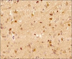 LC3B Antibody (1251B) - Azide and BSA Free, Novus Biologicals 0.1 mg; Unconjugated:Antibodies,