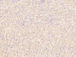 LCAT Antibody, Novus Biologicals:Antibodies:Primary Antibodies