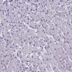 LCMT1 Antibody, Novus Biologicals:Antibodies:Primary Antibodies