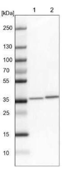 LCMT1 Antibody, Novus Biologicals:Antibodies:Primary Antibodies