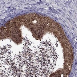 LCN9 Antibody, Novus Biologicals 25ul; Unconjugated:Antibodies, Polyclonal