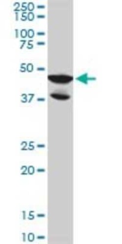 LDB2 Antibody (1A3), Novus Biologicals 0.1 mg | Buy Online | Novus Biologicals | Fisher Scientific