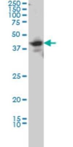 LDB2 Antibody (1A3), Novus Biologicals 0.1 mg | Buy Online | Novus Biologicals | Fisher Scientific