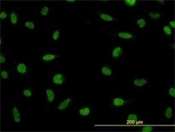 LDB2 Antibody (1C2), Novus Biologicals 0.1 mg | Buy Online | Novus Biologicals | Fisher Scientific