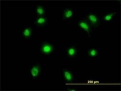 LDB2 Antibody (1C3), Novus Biologicals 0.1 mg | Buy Online | Novus Biologicals | Fisher Scientific