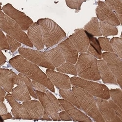 LDB3 Antibody, Novus Biologicals:Antibodies:Primary Antibodies