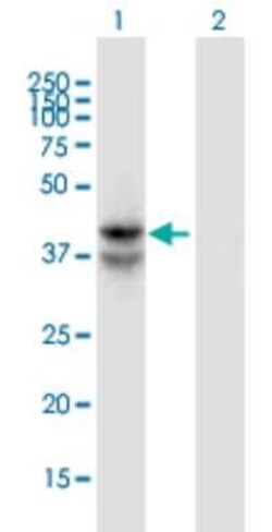LDHAL6B Antibody (1A3), Novus Biologicals 0.1 mg | Buy Online | Novus Biologicals | Fisher Scientific