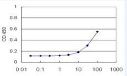 LDHAL6B Antibody (1C9), Novus Biologicals 0.1 mg; Unconjugated:Antibodies,