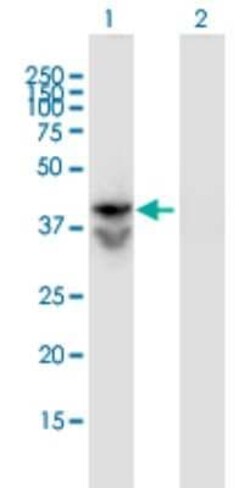 LDHAL6B Antibody (1C9), Novus Biologicals 0.1 mg; Unconjugated:Antibodies,