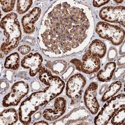 LDHD Antibody, Novus Biologicals:Antibodies:Primary Antibodies