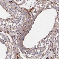 LDHD Antibody, Novus Biologicals:Antibodies:Primary Antibodies