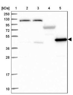 LDHD Antibody, Novus Biologicals:Antibodies:Primary Antibodies