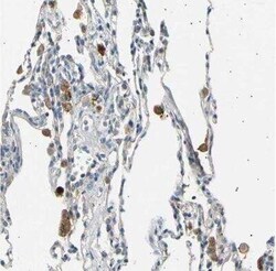 LDLR Antibody, Novus Biologicals 25 &mu;L | Buy Online | Novus Biologicals | Fisher Scientific