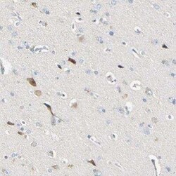 LDLR Antibody, Novus Biologicals 25 &mu;L | Buy Online | Novus Biologicals | Fisher Scientific