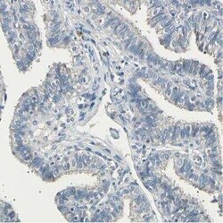 LDLR Antibody, Novus Biologicals 25 &mu;L | Buy Online | Novus Biologicals | Fisher Scientific