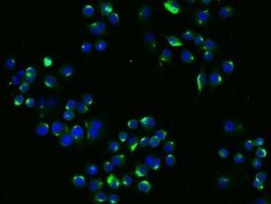 LDLR Rabbit anti-Mouse, Clone: 4, Novus Biologicals:Antibodies:Primary
