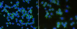 LDLR Rabbit anti-Mouse, Clone: 32, Novus Biologicals:Antibodies:Primary
