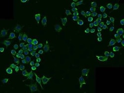 LDLR Rabbit anti-Mouse, Clone: 101, Novus Biologicals 100 &mu;g; Unconjugated:Antibodies,