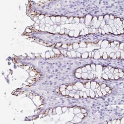 LDLRAD1 Antibody, Novus Biologicals 25 &mu;L, Unconjugated:Antibodies,