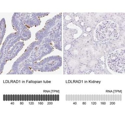 LDLRAD1 Antibody, Novus Biologicals 25 &mu;L, Unconjugated:Antibodies,
