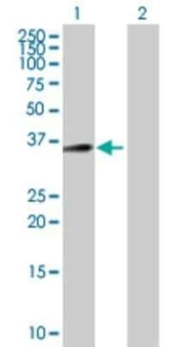 LDLRAD4 Antibody, Novus Biologicals 0.05 mg | Buy Online | Novus Biologicals | Fisher Scientific